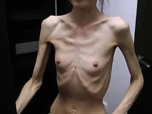 Anorexic Denisa posing and has ribs moved
